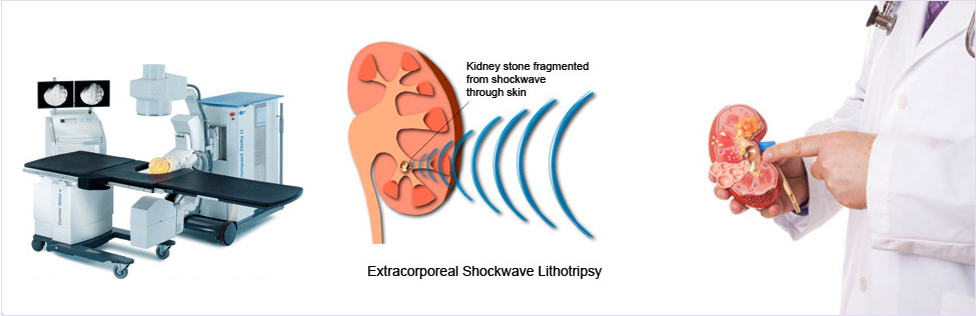 Best Urology Center in Delhi